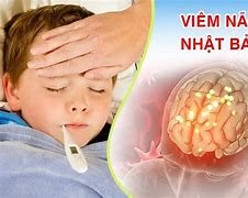 Mùa Mắc Bệnh Viêm Não Nhật Bản B Là