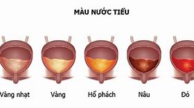 Trong Nước Tiểu Có Gì